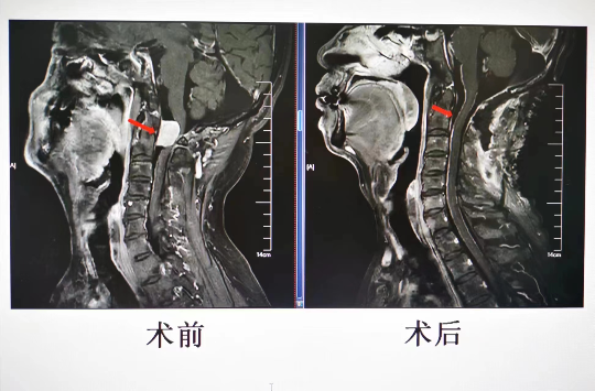 已编辑图片